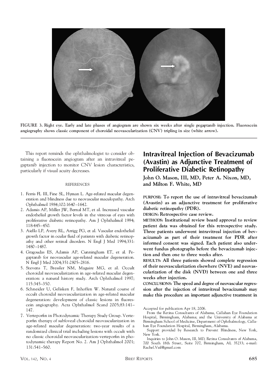 Intravitreal Injection of Bevacizumab (Avastin) as Adjunctive Treatment of Proliferative Diabetic Retinopathy 