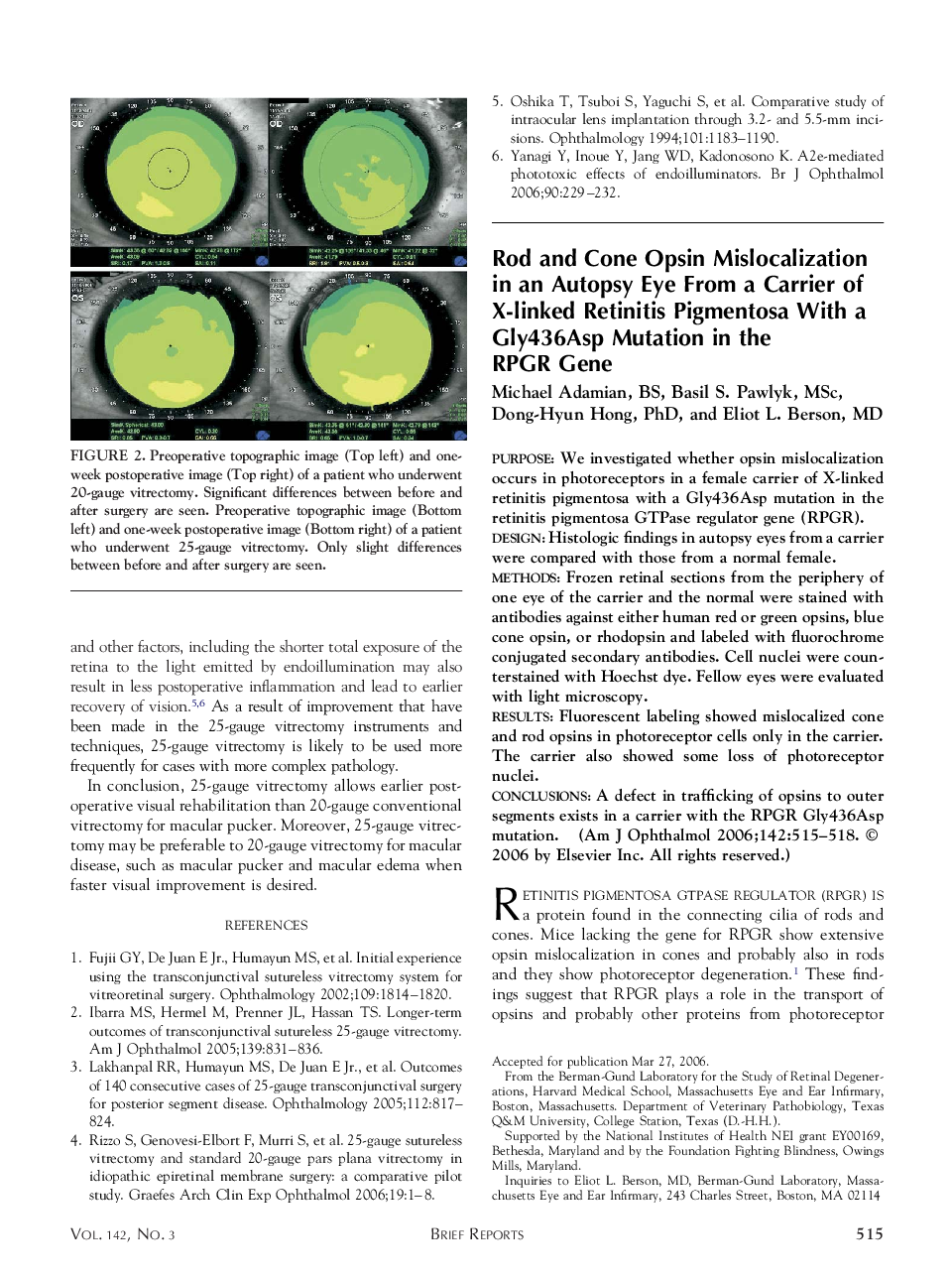 Rod and Cone Opsin Mislocalization in an Autopsy Eye From a Carrier of X-linked Retinitis Pigmentosa With a Gly436Asp Mutation in the RPGR Gene 