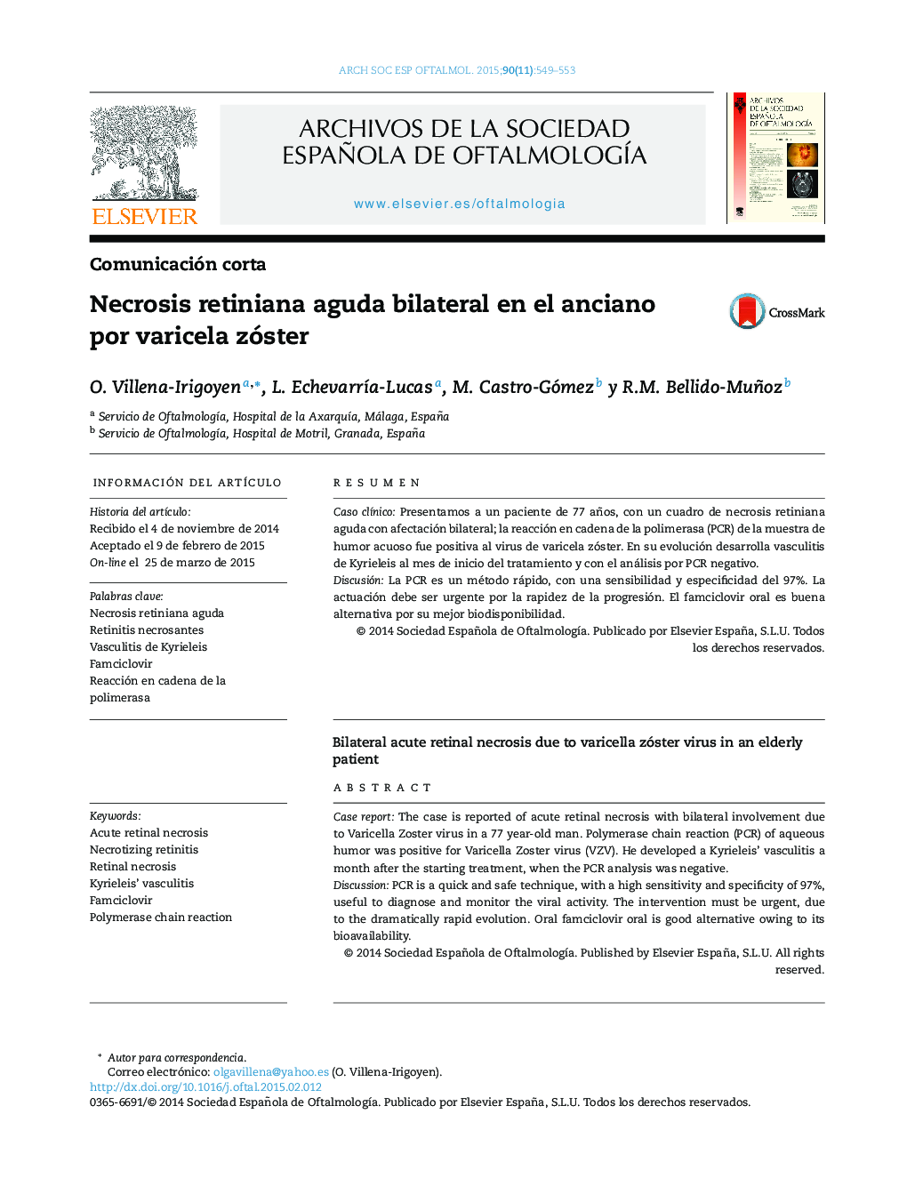 Necrosis retiniana aguda bilateral en el anciano por varicela zóster