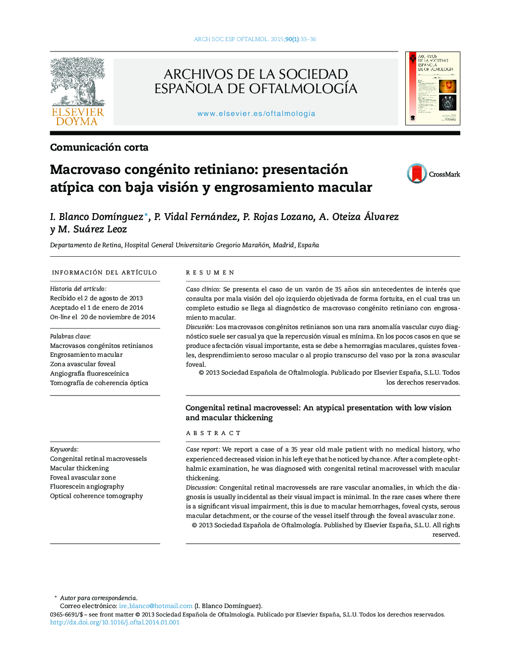 Macrovaso congénito retiniano: presentación atípica con baja visión y engrosamiento macular