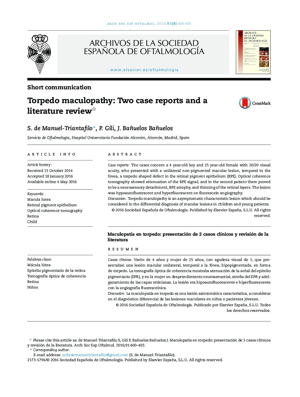 maculopathy Torpedo: گزارش دو مورد و بررسی مقالات