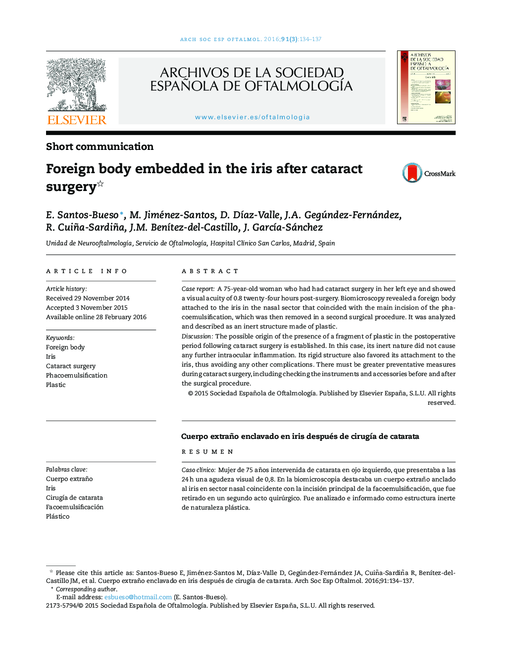 Foreign body embedded in the iris after cataract surgery 