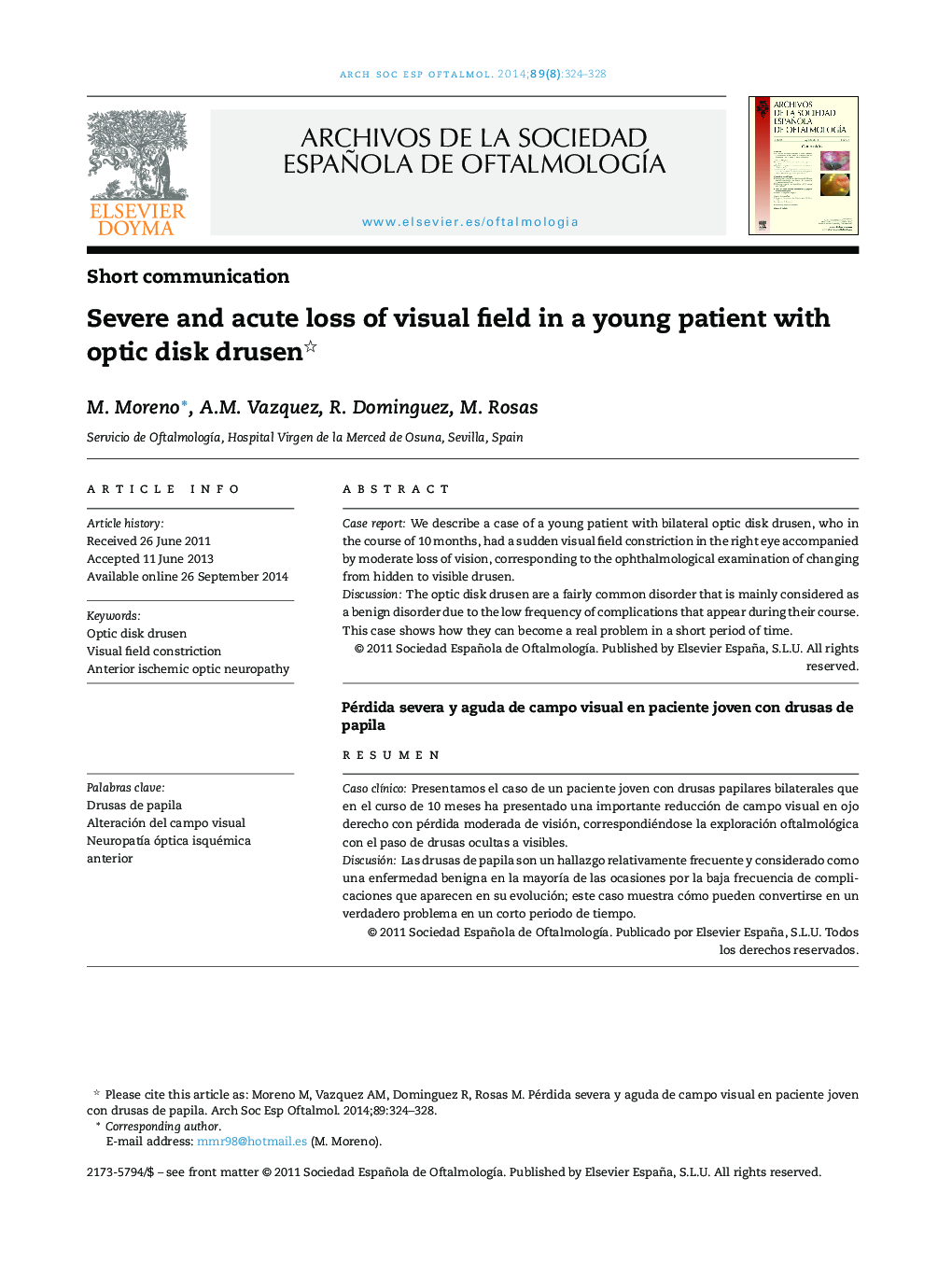 Severe and acute loss of visual field in a young patient with optic disk drusen 