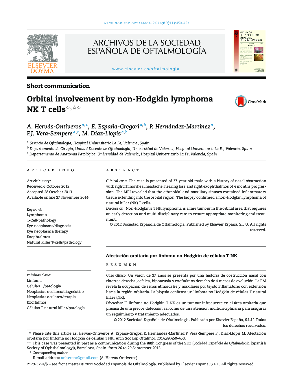 Orbital involvement by non-Hodgkin lymphoma NK T cells