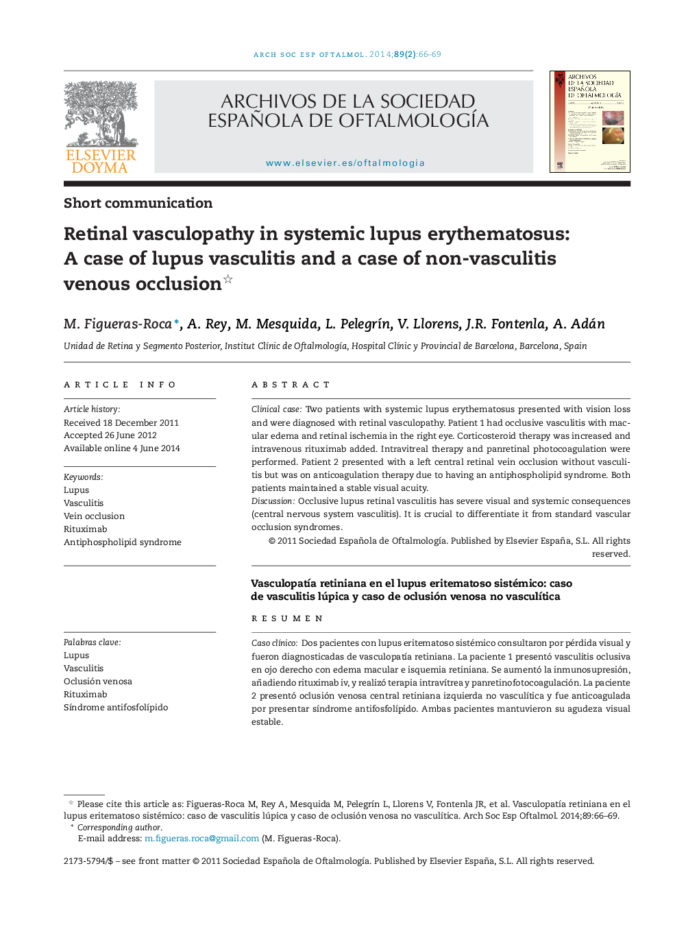 Retinal vasculopathy in systemic lupus erythematosus: A case of lupus vasculitis and a case of non-vasculitis venous occlusion 