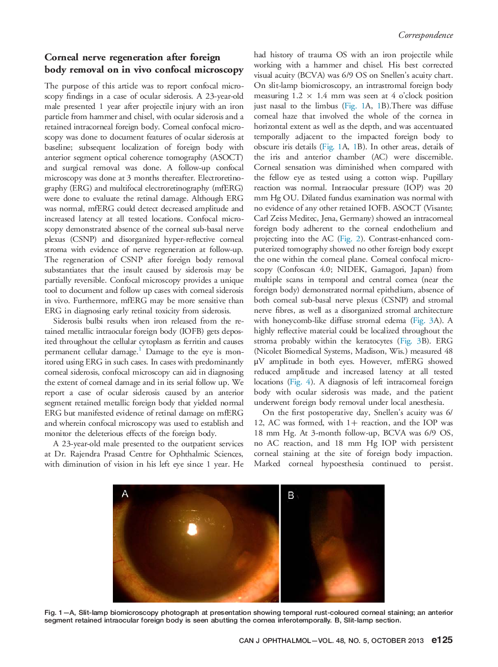 Corneal nerve regeneration after foreign body removal on in vivo confocal microscopy