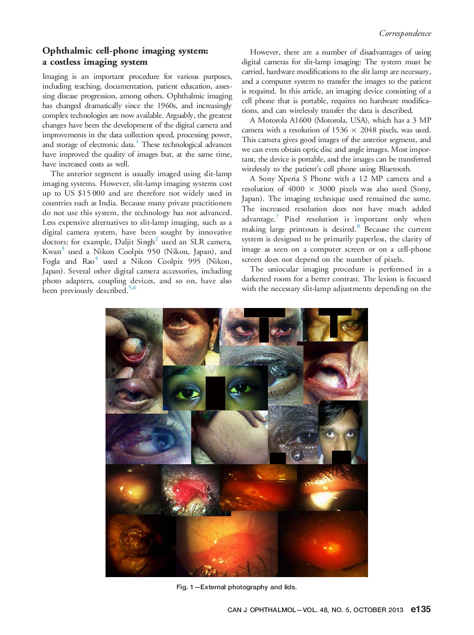 Ophthalmic cell-phone imaging system: a costless imaging system
