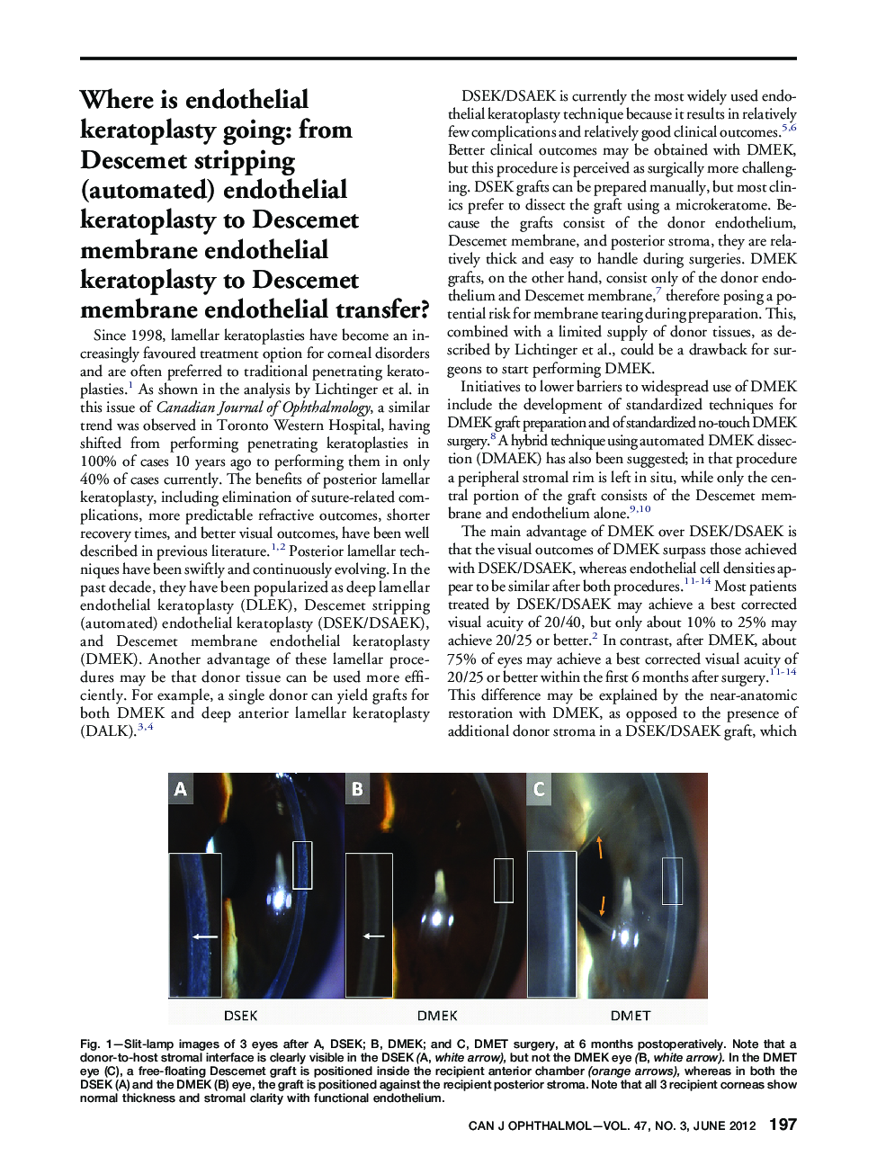 Where is endothelial keratoplasty going: from Descemet stripping (automated) endothelial keratoplasty to Descemet membrane endothelial keratoplasty to Descemet membrane endothelial transfer?