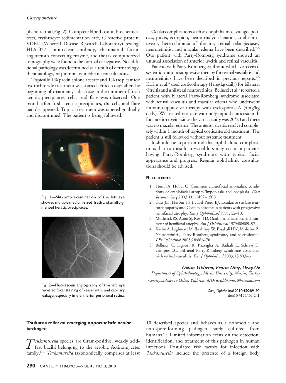 Tsukamurella: an emerging opportunistic ocular pathogen