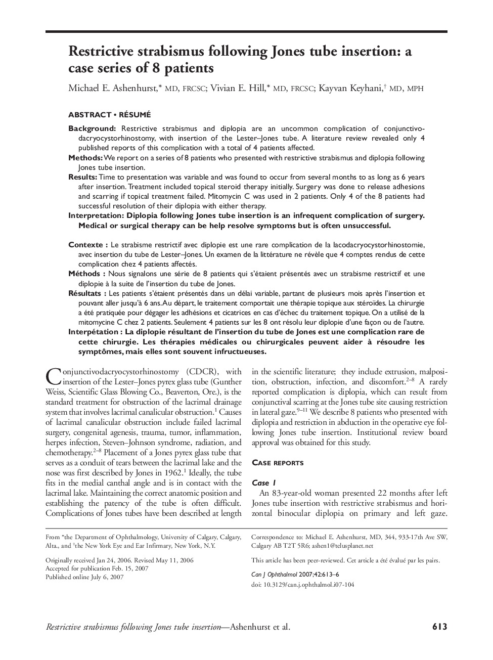 Restrictive strabismus following Jones tube insertion: a case series of 8 patients ‡