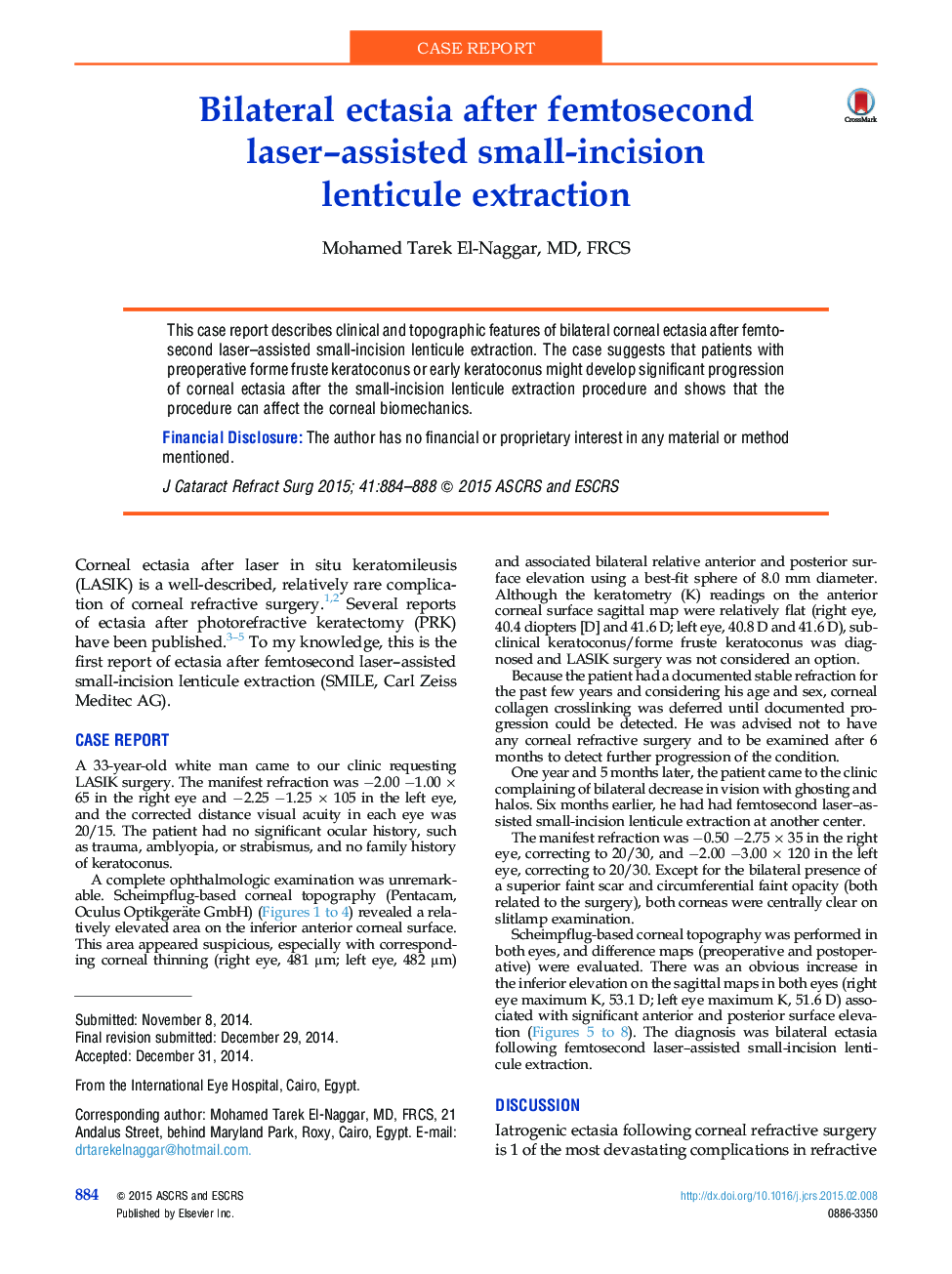 Bilateral ectasia after femtosecond laser–assisted small-incision lenticule extraction