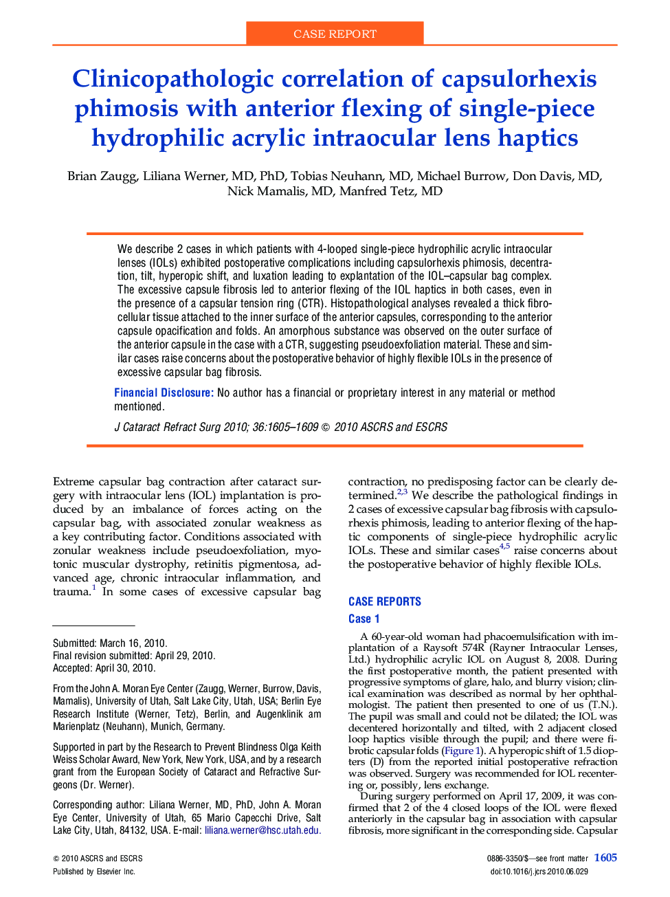 Clinicopathologic correlation of capsulorhexis phimosis with anterior flexing of single-piece hydrophilic acrylic intraocular lens haptics