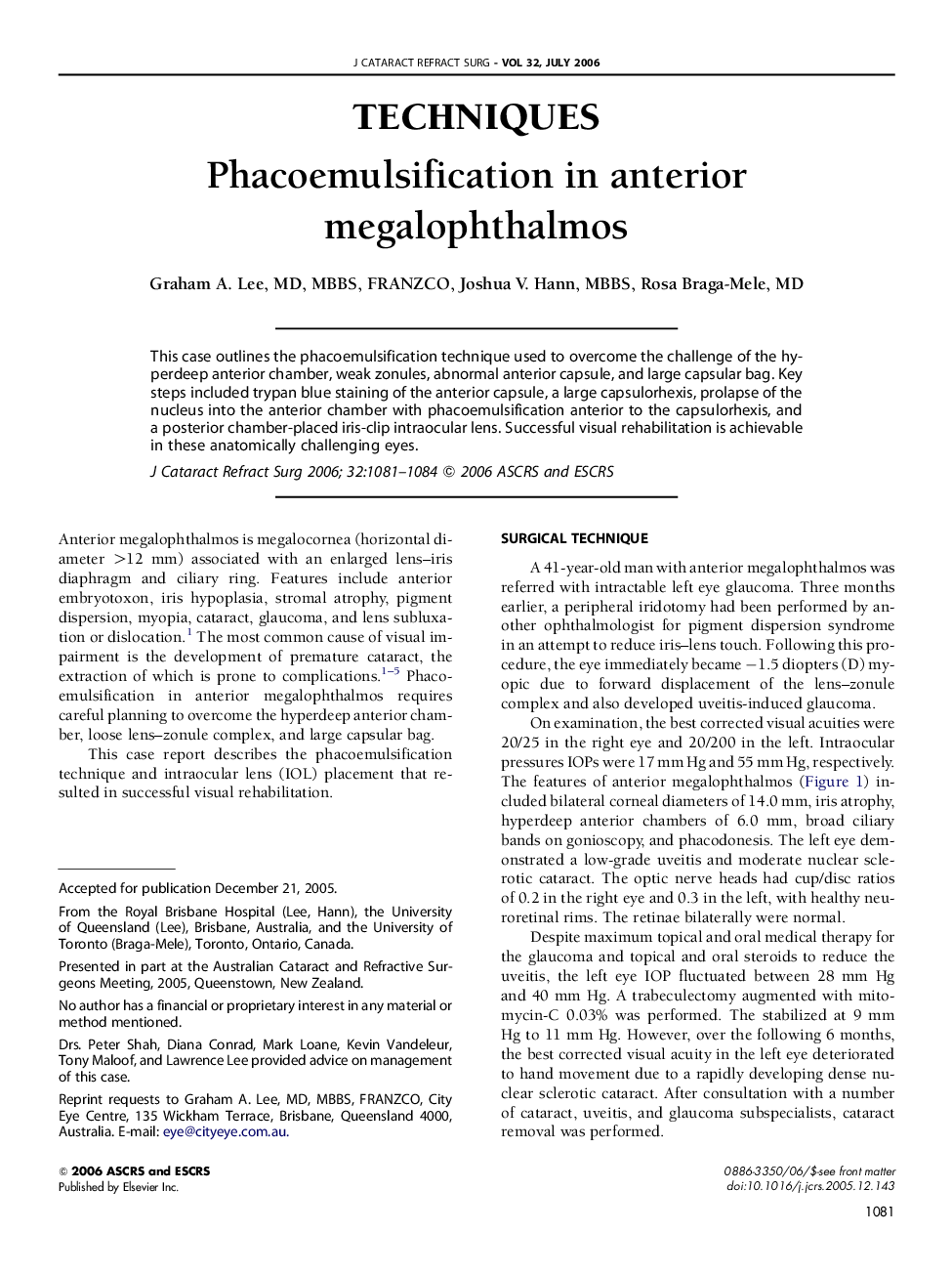 Phacoemulsification in anterior megalophthalmos