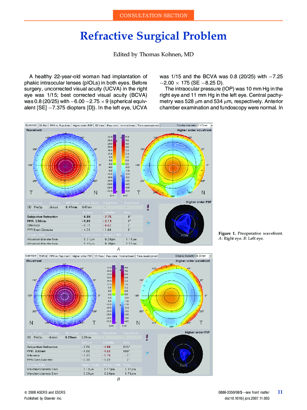 Refractive surgical problem