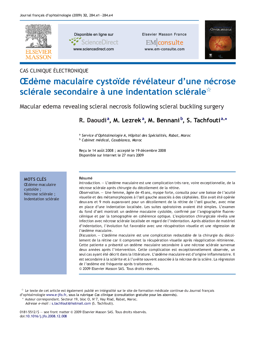 ÅdÃ¨me maculaire cystoïde révélateur d'une nécrose sclérale secondaire Ã  une indentation sclérale