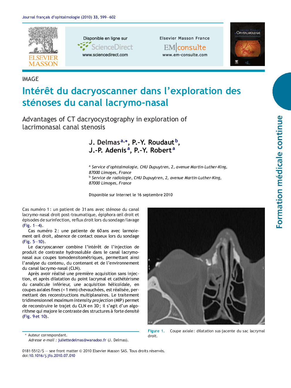 IntérÃªt du dacryoscanner dans l'exploration des sténoses du canal lacrymo-nasal