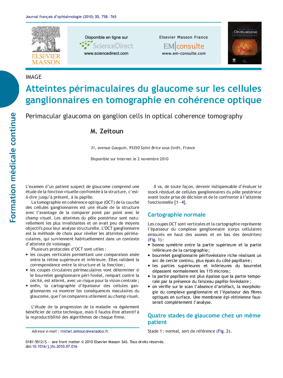 Atteintes périmaculaires du glaucome sur les cellules ganglionnaires en tomographie en cohérence optique