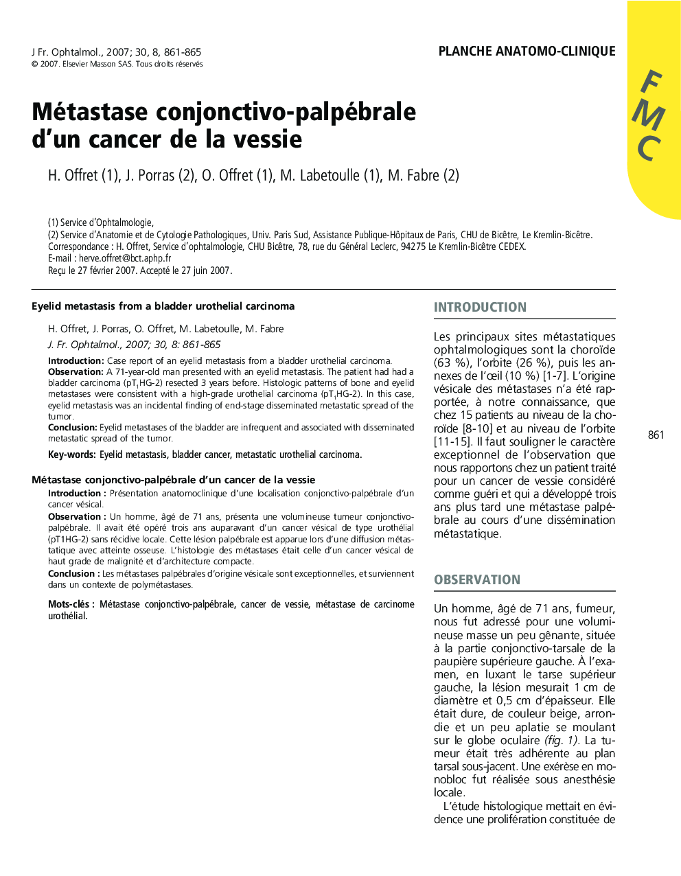 Planche anatomo-cliniqueMétastase conjonctivo-palpébrale d'un cancer de la vessieEyelid metastasis from a bladder urothelial carcinoma