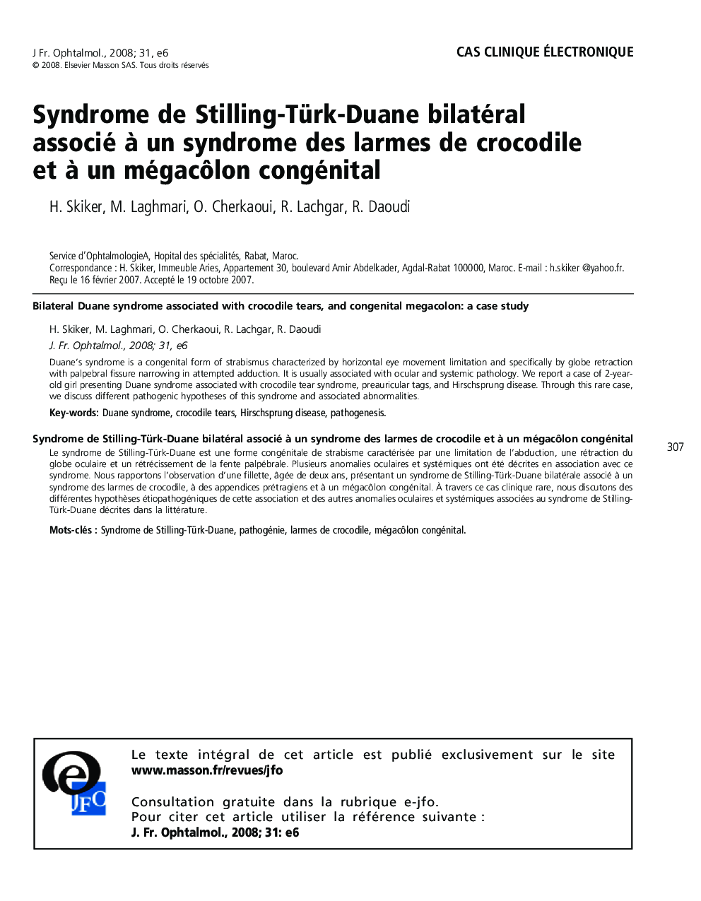 Syndrome de Stilling-Türk-Duane bilatéral associé Ã  un syndrome des larmes de crocodile et Ã  un mégacÃ´lon congénital