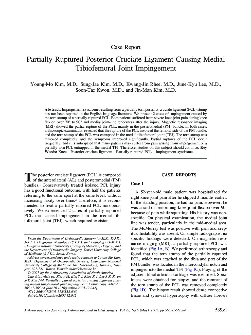 Partially Ruptured Posterior Cruciate Ligament Causing Medial Tibiofemoral Joint Impingement