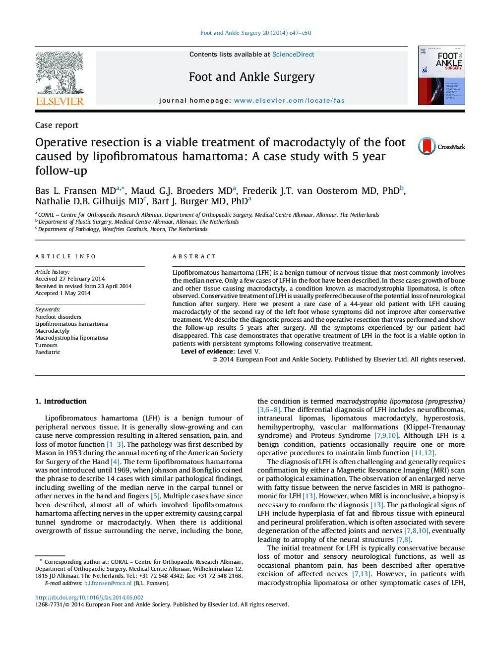 Operative resection is a viable treatment of macrodactyly of the foot caused by lipofibromatous hamartoma: A case study with 5 year follow-up