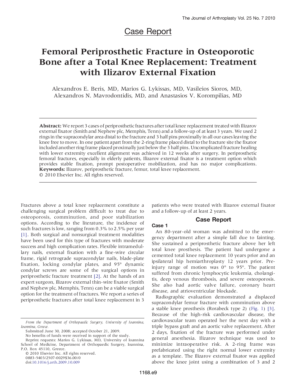 Femoral Periprosthetic Fracture in Osteoporotic Bone after a Total Knee Replacement: Treatment with Ilizarov External Fixation