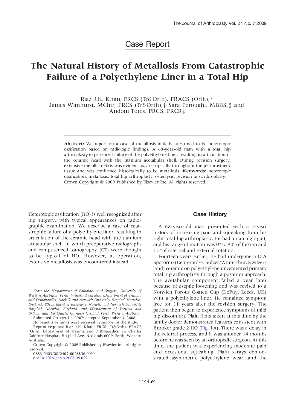 The Natural History of Metallosis From Catastrophic Failure of a Polyethylene Liner in a Total Hip