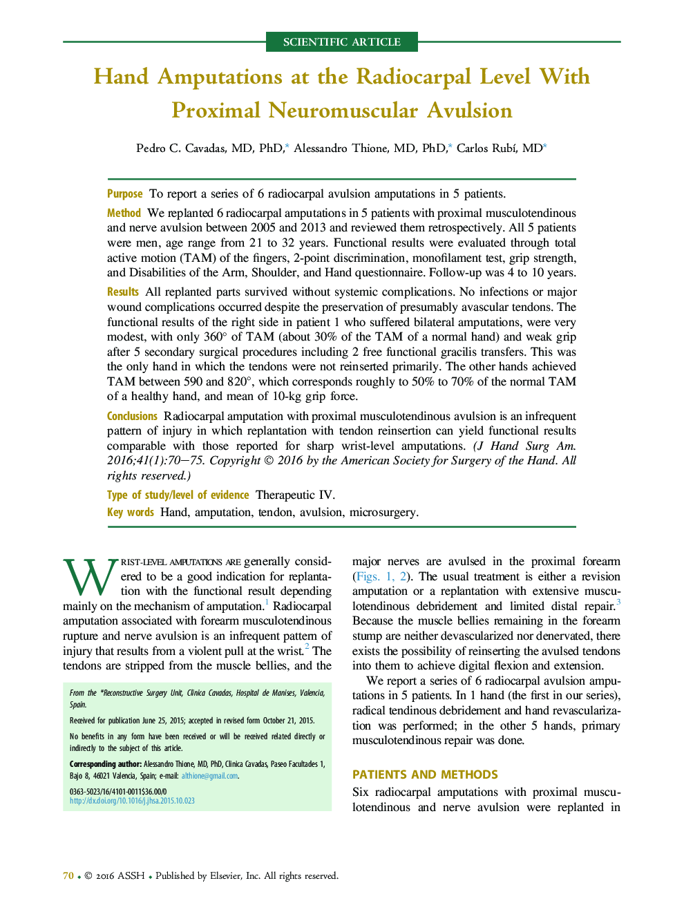 Hand Amputations at the Radiocarpal Level With Proximal Neuromuscular Avulsion 