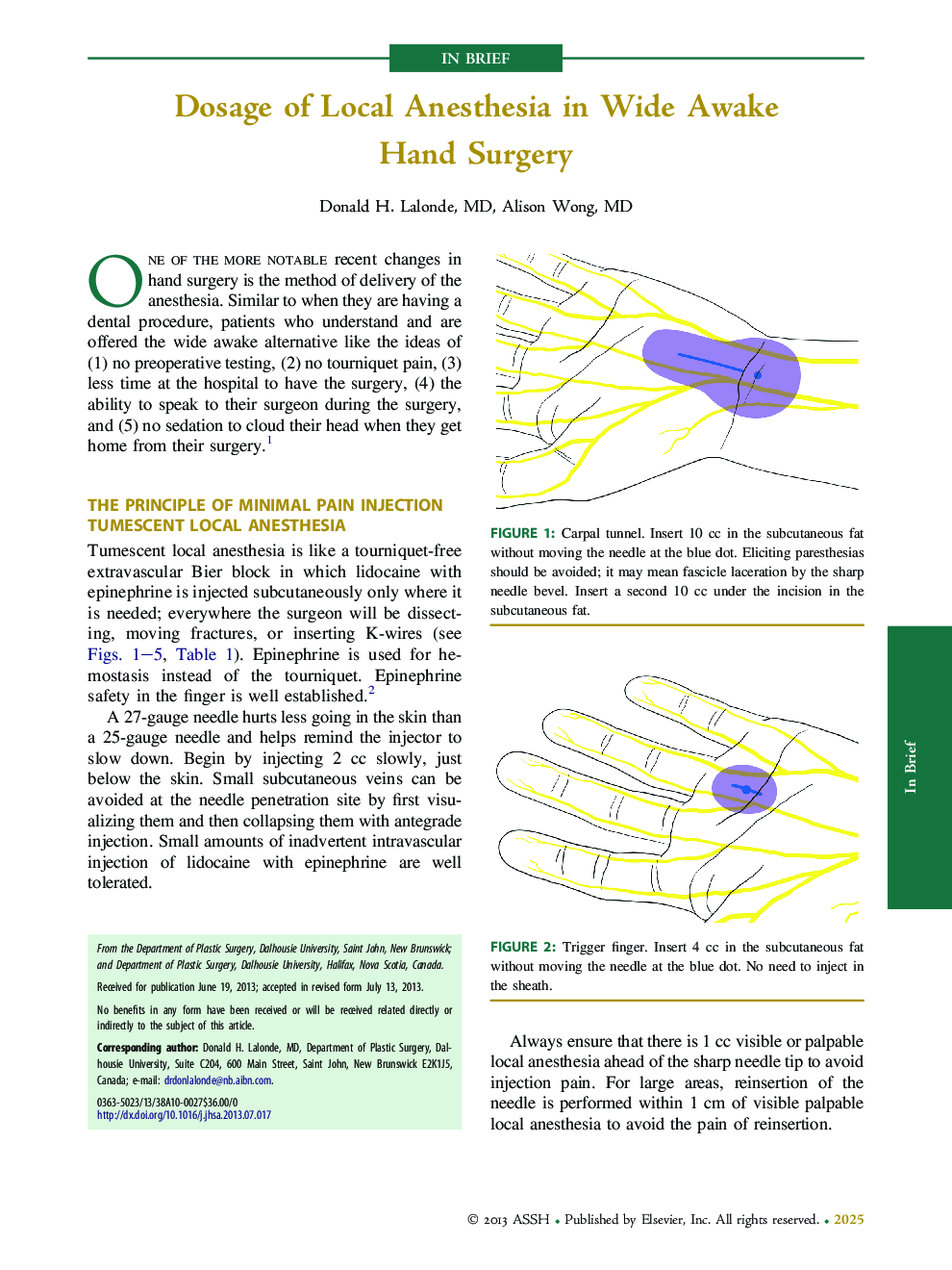 Dosage of Local Anesthesia in Wide Awake Hand Surgery