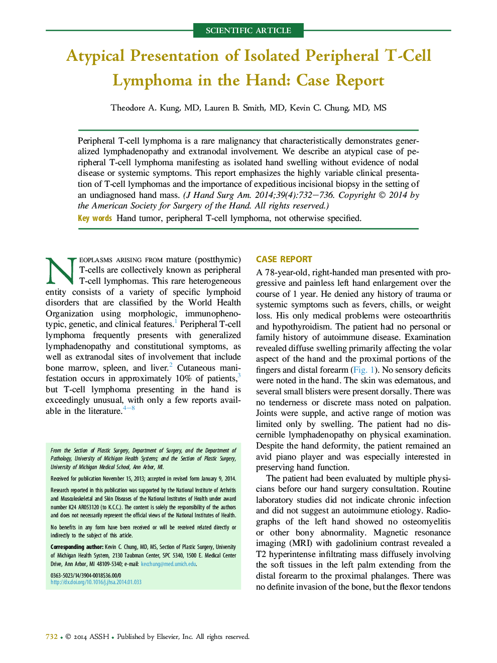 Atypical Presentation of Isolated Peripheral T-Cell Lymphoma in the Hand: Case Report 