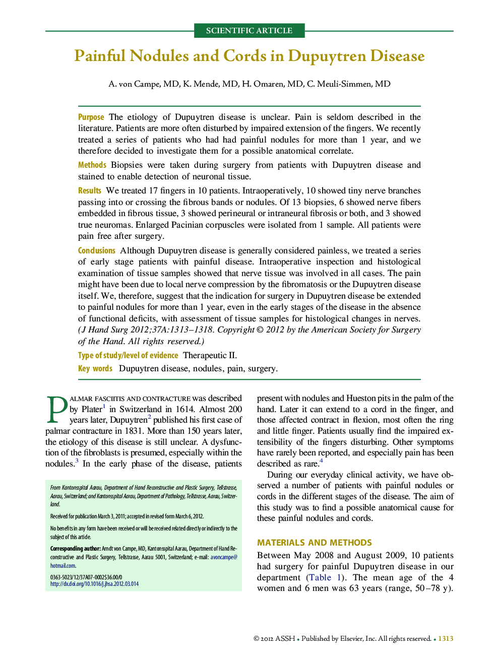 Painful Nodules and Cords in Dupuytren Disease 