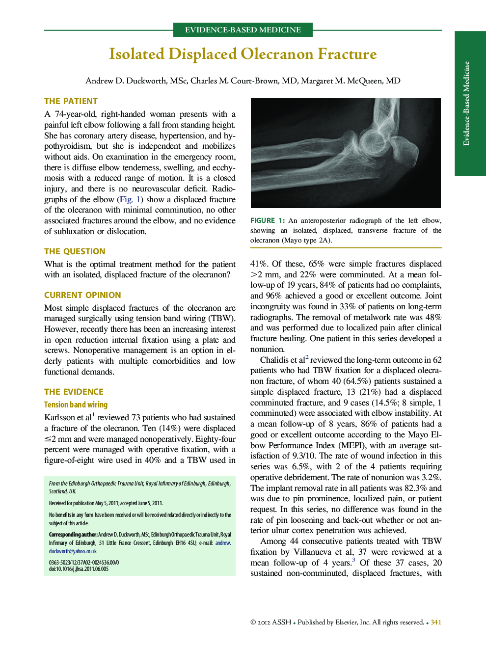 عکس صفحه اول مقاله: Isolated Displaced Olecranon Fracture Isolated Displaced Olecranon Fracture