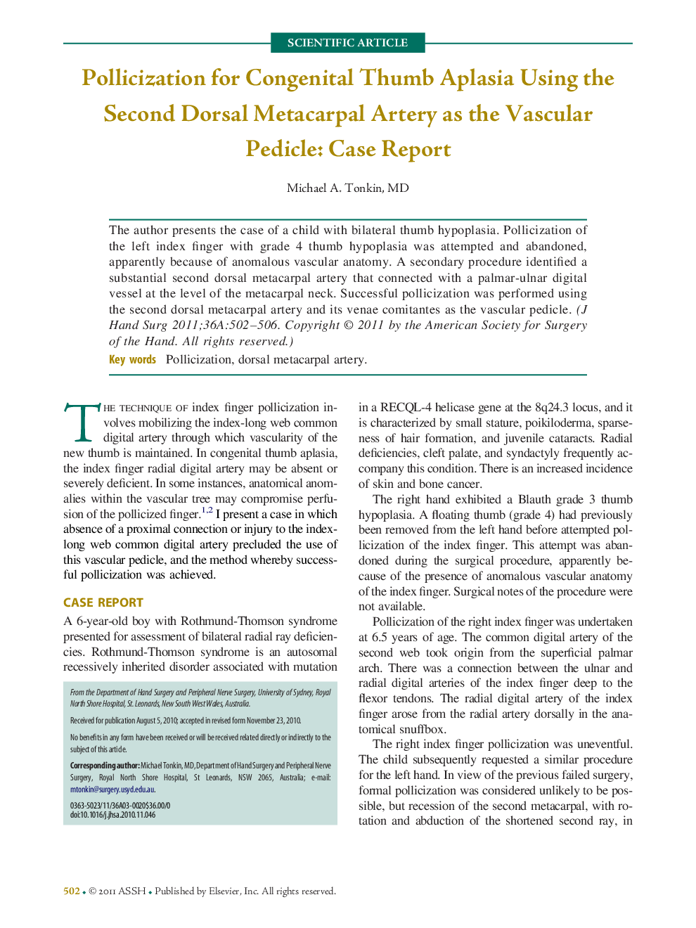 Pollicization for Congenital Thumb Aplasia Using the Second Dorsal Metacarpal Artery as the Vascular Pedicle: Case Report 