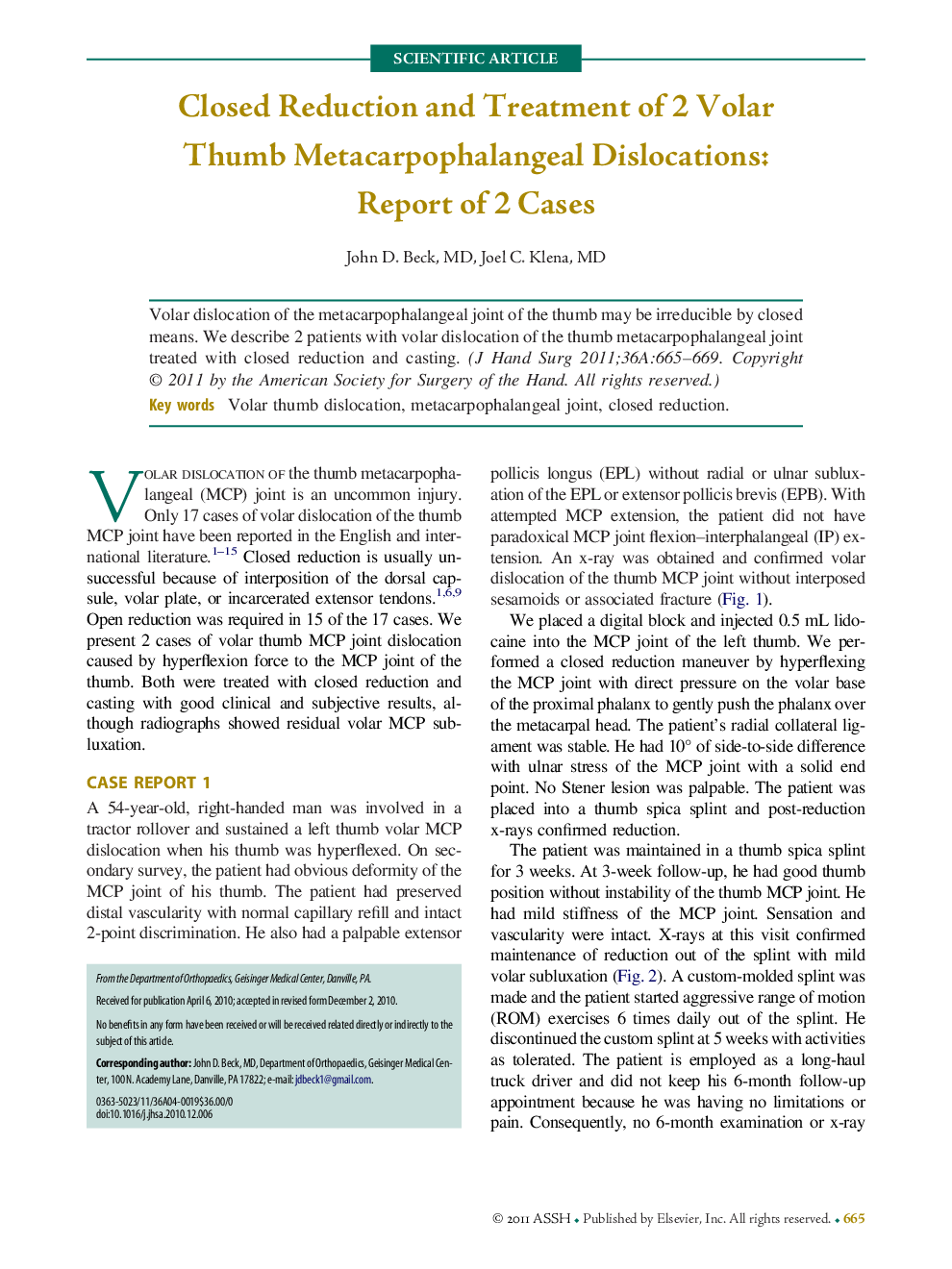 Closed Reduction and Treatment of 2 Volar Thumb Metacarpophalangeal Dislocations: Report of 2 Cases 