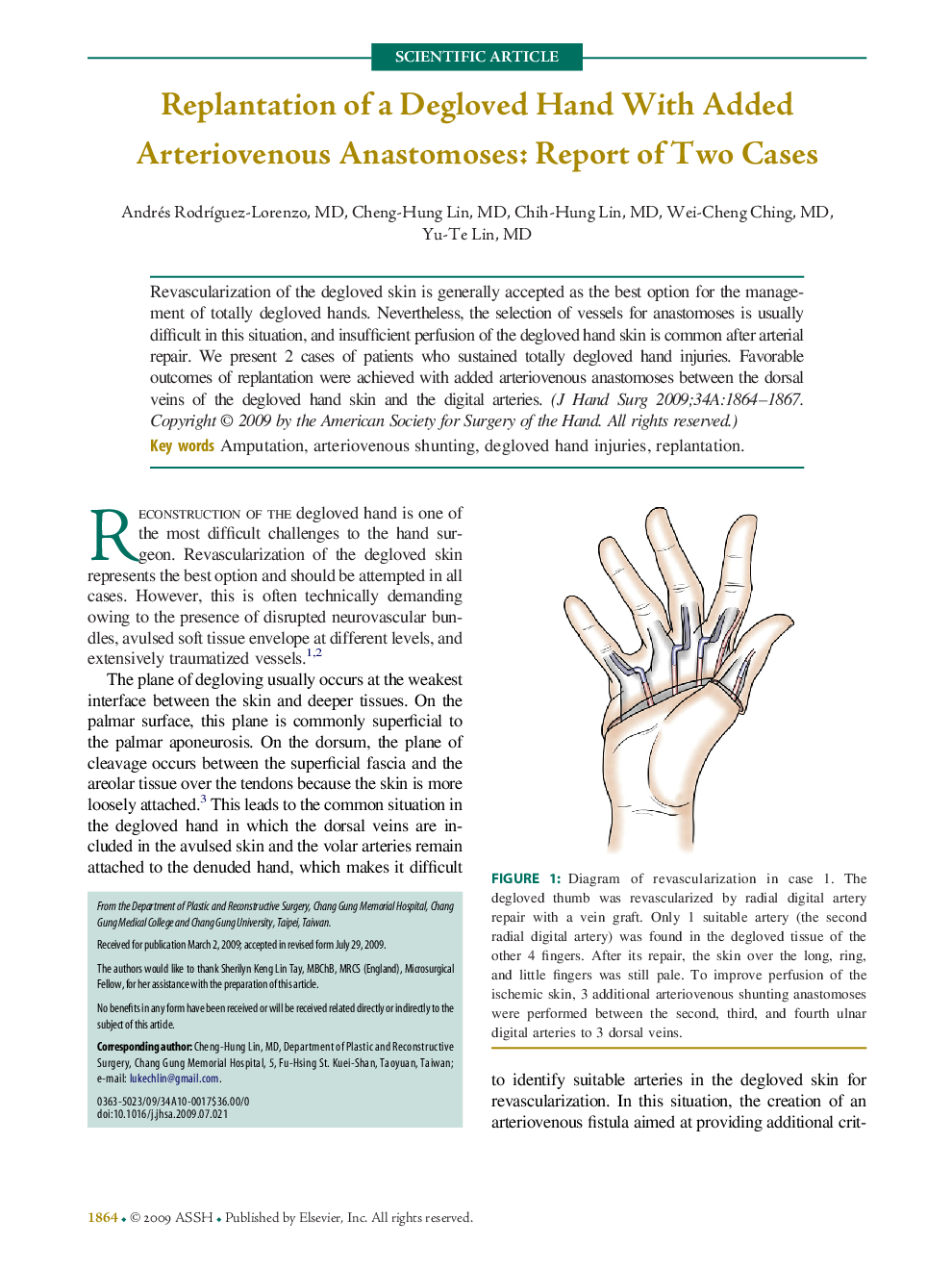 Replantation of a Degloved Hand With Added Arteriovenous Anastomoses: Report of Two Cases