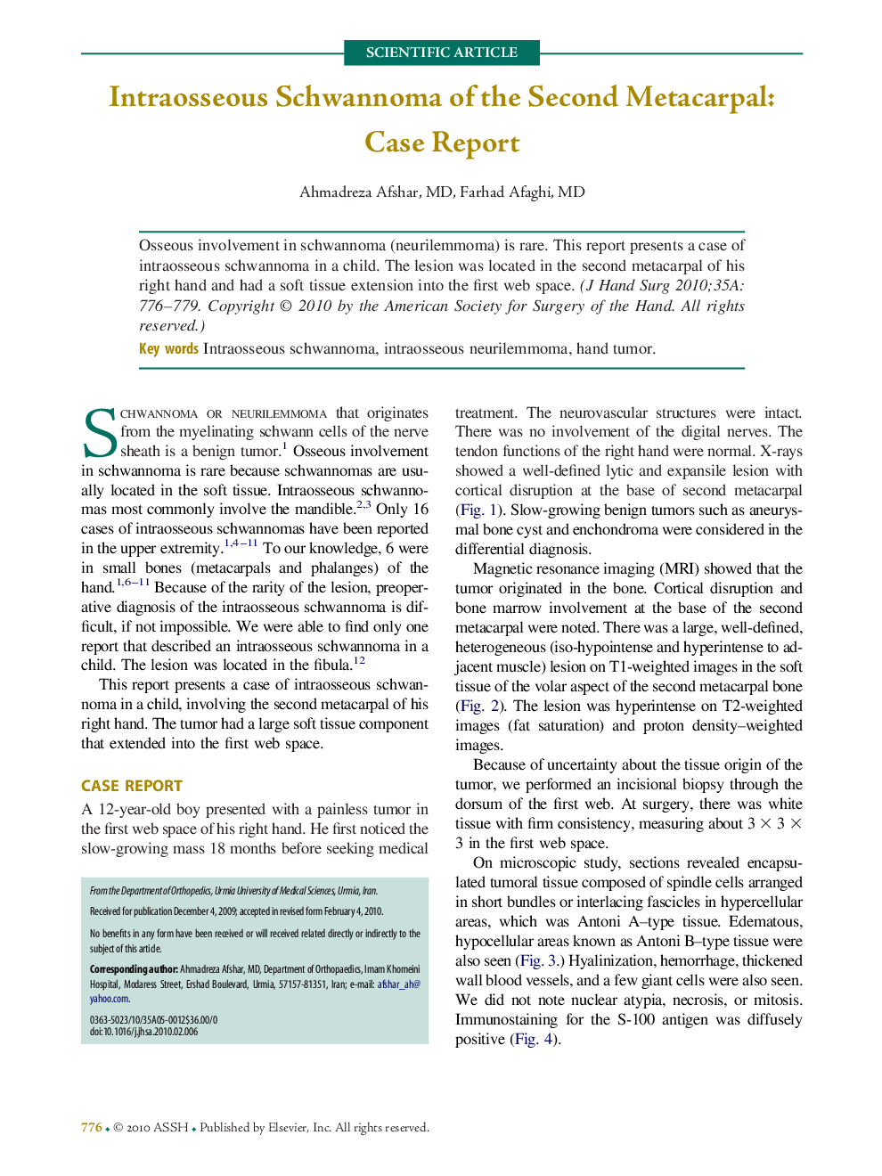 Intraosseous Schwannoma of the Second Metacarpal: Case Report