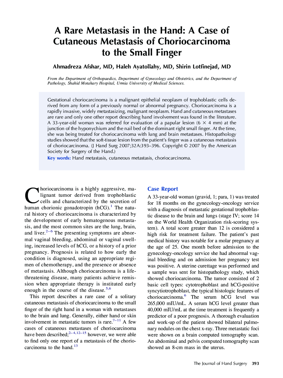 A Rare Metastasis in the Hand: A Case of Cutaneous Metastasis of Choriocarcinoma to the Small Finger 