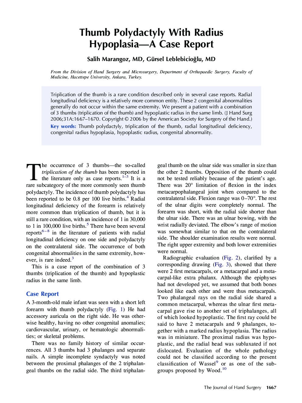 Thumb Polydactyly With Radius Hypoplasia—A Case Report 