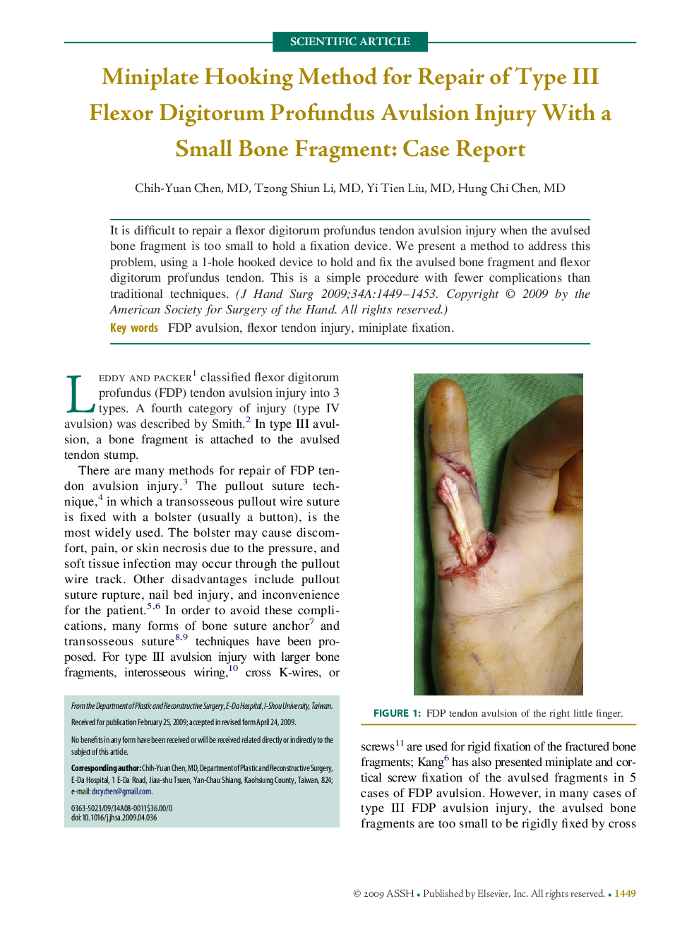 Miniplate Hooking Method for Repair of Type III Flexor Digitorum Profundus Avulsion Injury With a Small Bone Fragment: Case Report 