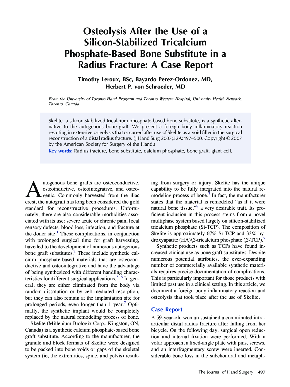 Osteolysis After the Use of a Silicon-Stabilized Tricalcium Phosphate-Based Bone Substitute in a Radius Fracture: A Case Report 