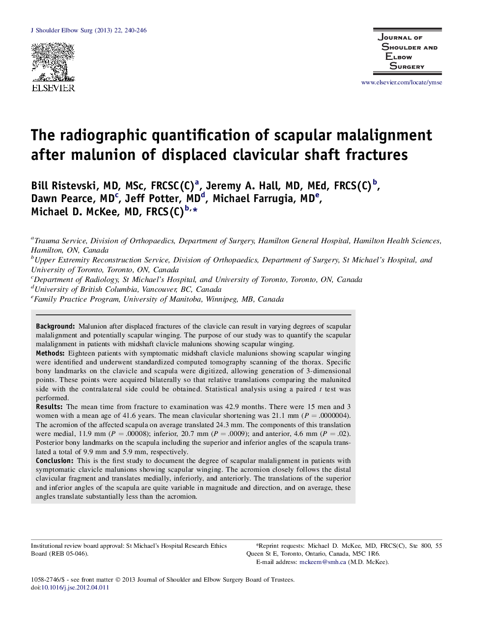 The radiographic quantification of scapular malalignment after malunion of displaced clavicular shaft fractures 