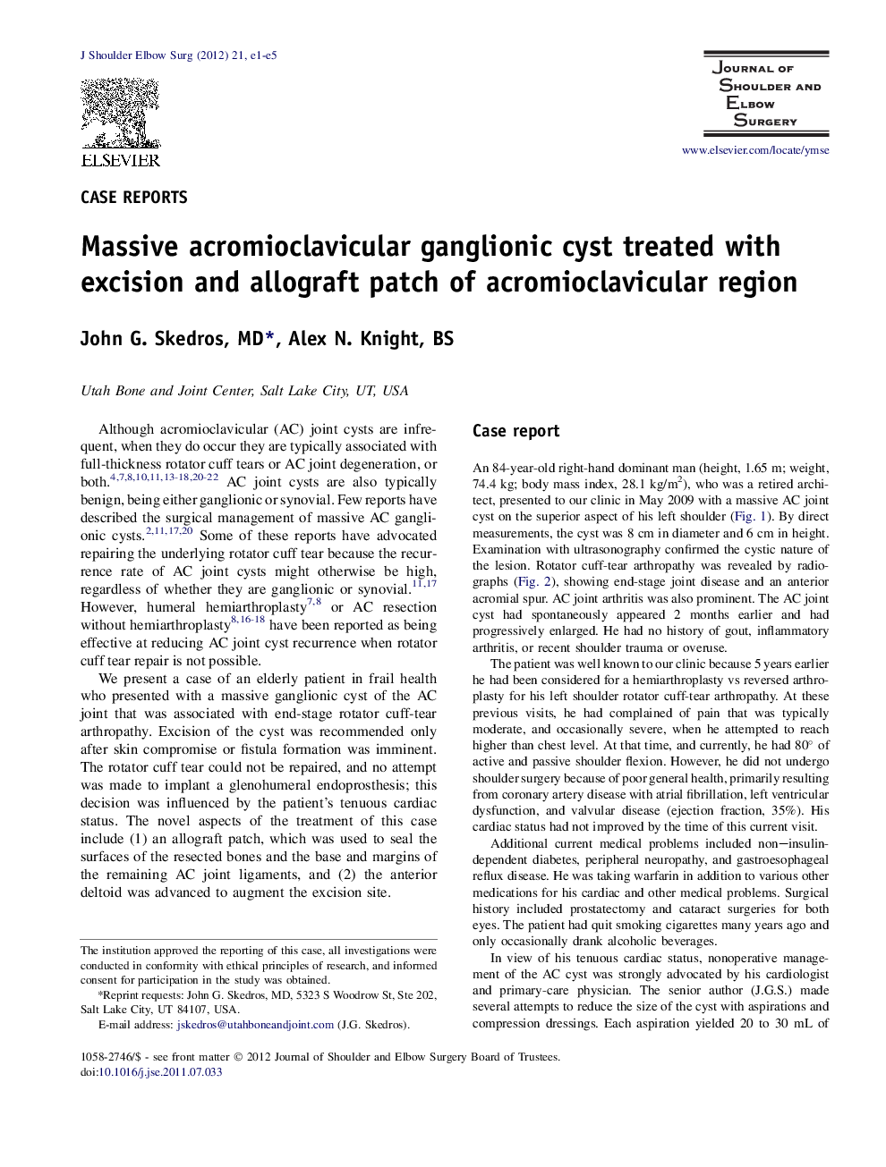 Massive acromioclavicular ganglionic cyst treated with excision and allograft patch of acromioclavicular region