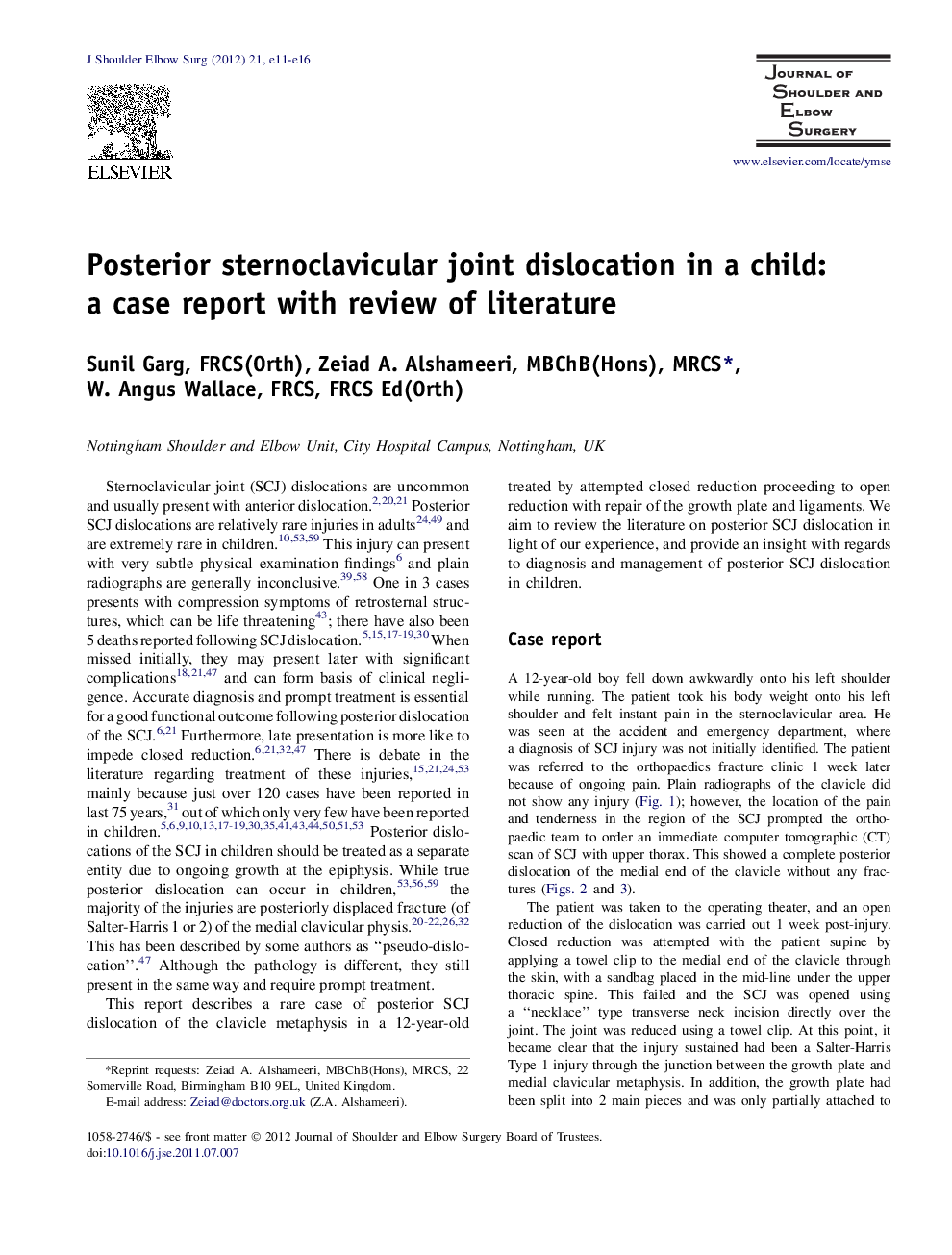 Posterior sternoclavicular joint dislocation in a child: a case report with review of literature