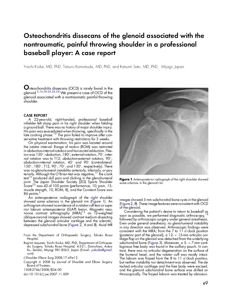 Osteochondritis dissecans of the glenoid associated with the nontraumatic, painful throwing shoulder in a professional baseball player: A case report
