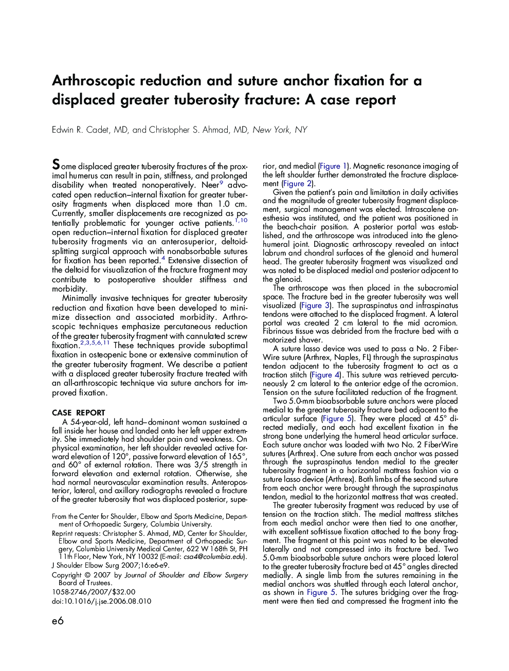 Arthroscopic reduction and suture anchor fixation for a displaced greater tuberosity fracture: A case report