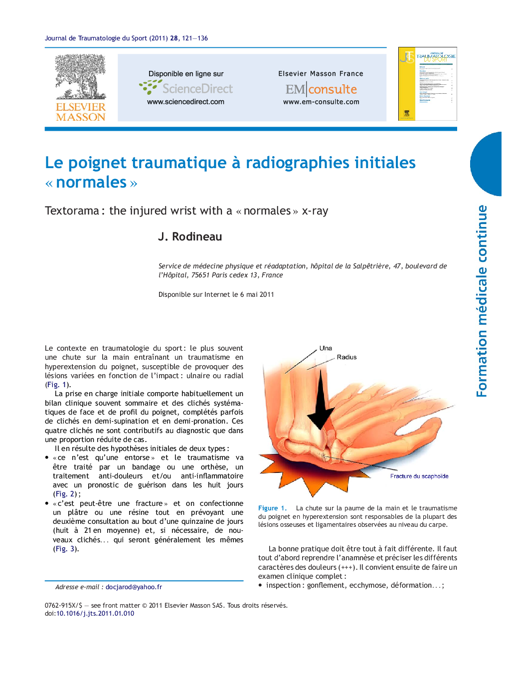 Le poignet traumatique Ã  radiographies initiales Â«Â normalesÂ Â»