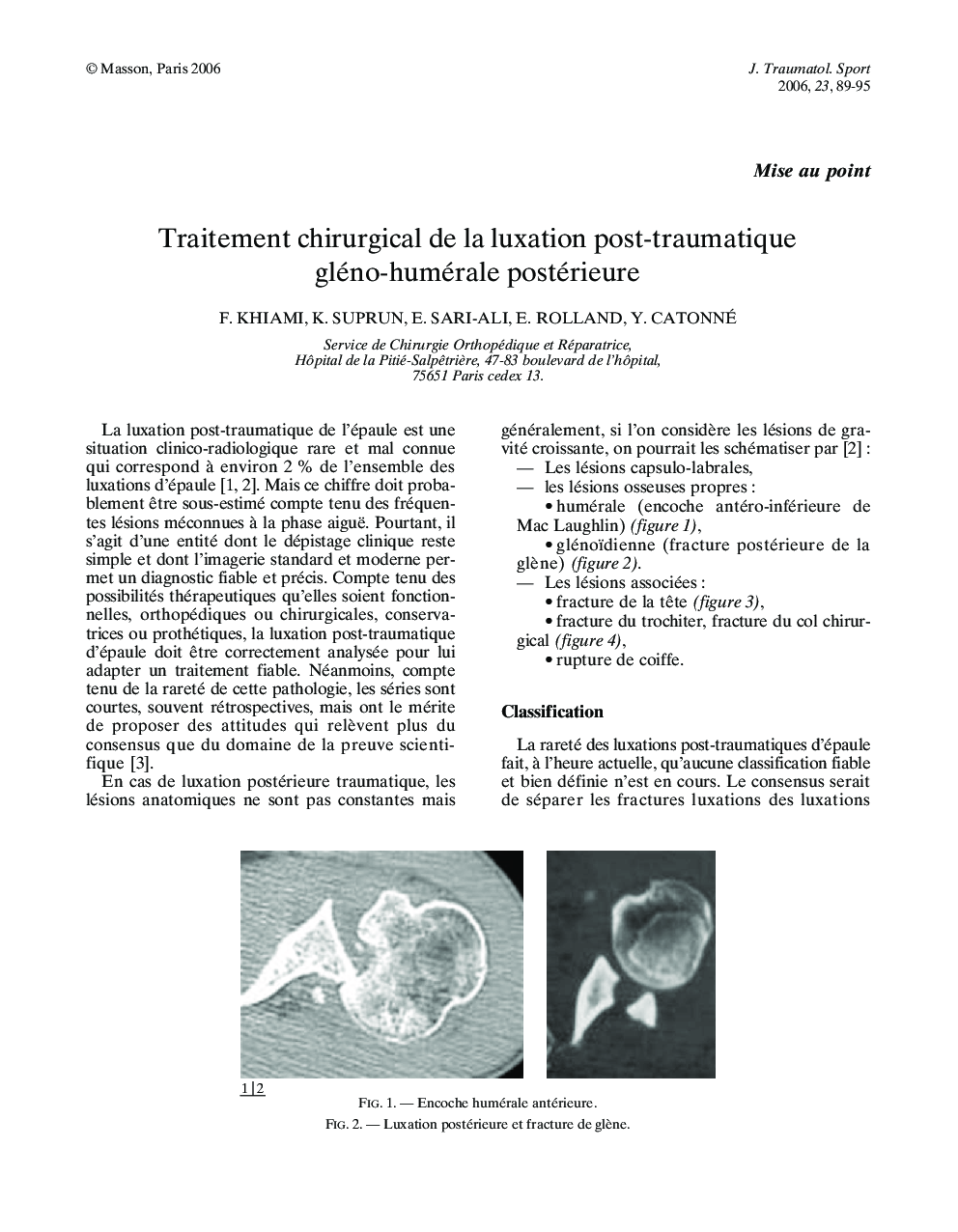 Traitement chirurgical de la luxation post-traumatique gléno-humérale postérieure