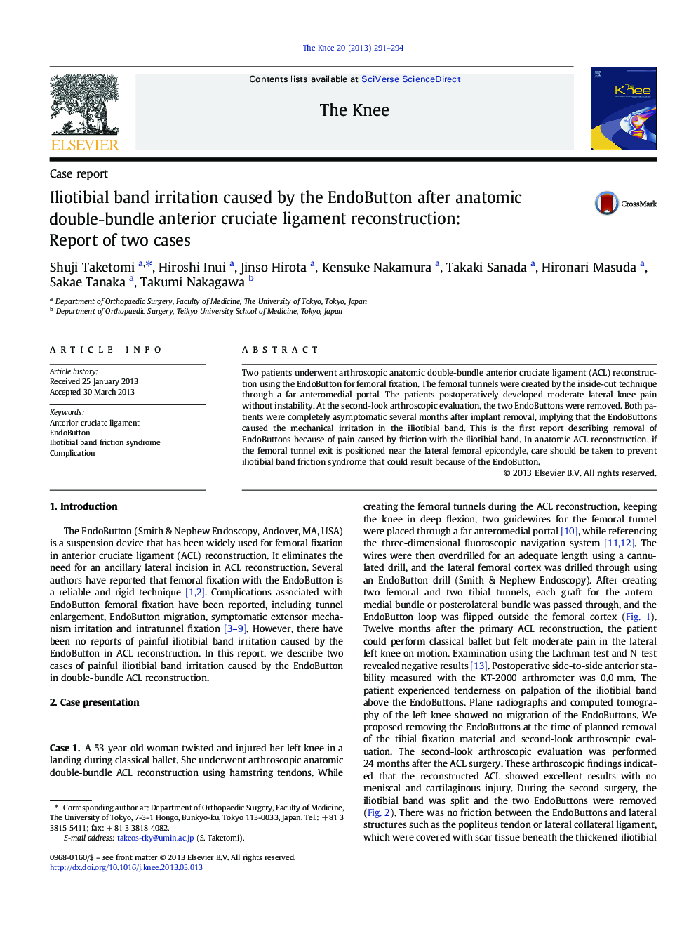Iliotibial band irritation caused by the EndoButton after anatomic double-bundle anterior cruciate ligament reconstruction: Report of two cases