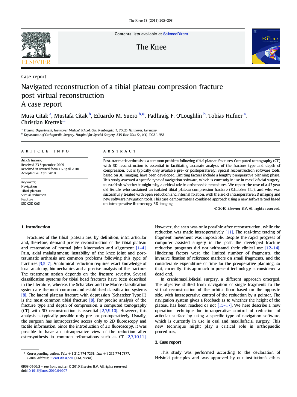 Navigated reconstruction of a tibial plateau compression fracture post-virtual reconstruction: A case report