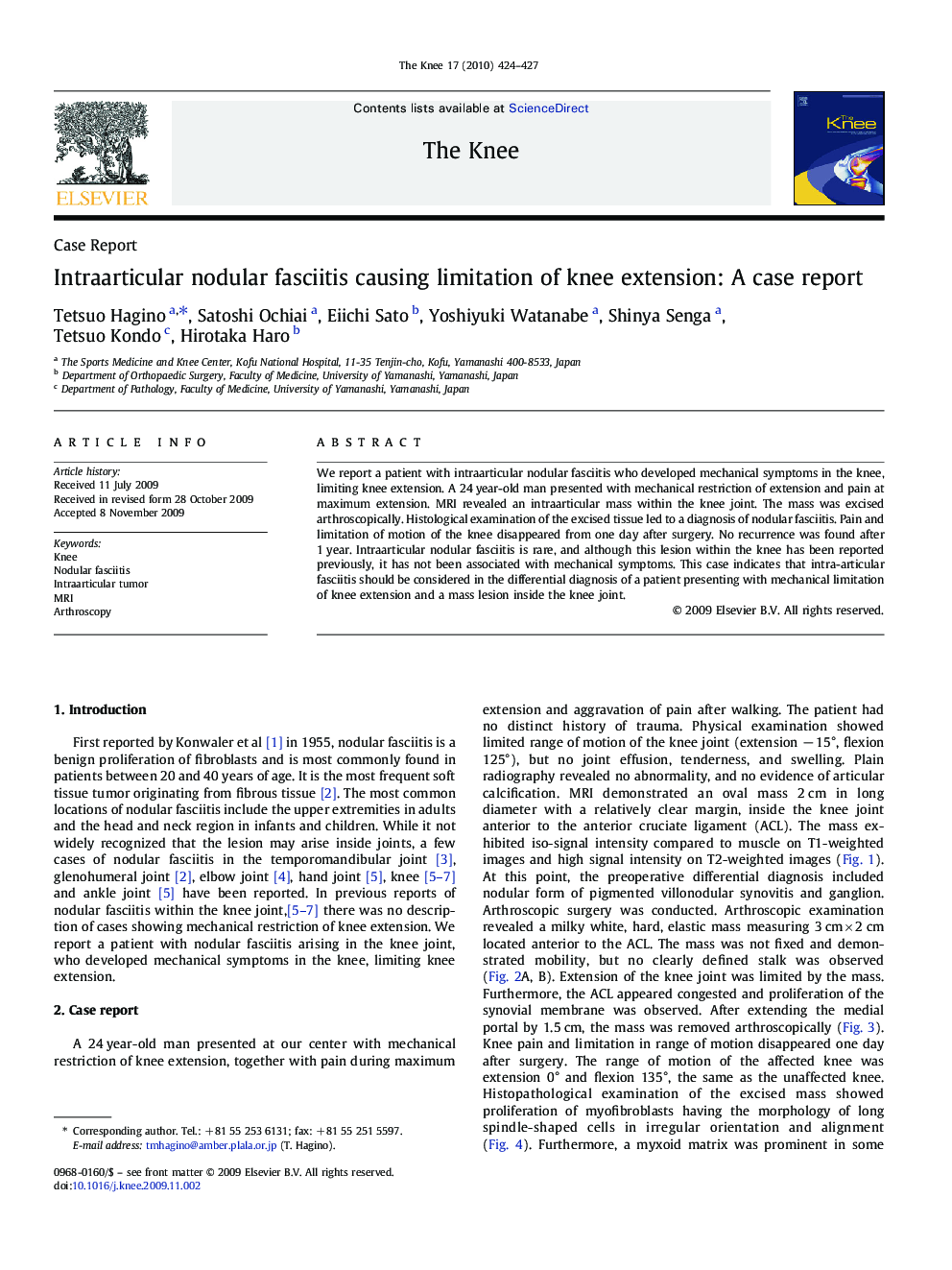 Intraarticular nodular fasciitis causing limitation of knee extension: A case report